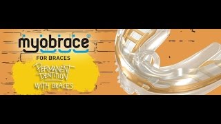 Myobrace for braces [upl. by Enailuj]