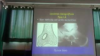 Traumatología  Tumores óseos 12 [upl. by Kcinemod]