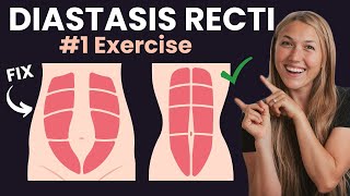 BEST Diastasis Recti Exercise To Strengthen Core  Postpartum Fitness Specialist [upl. by Anaoy]