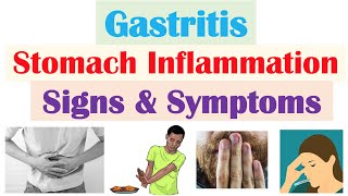 Gastritis Stomach Inflammation Signs amp Symptoms Complications amp Why They Occur [upl. by Carpet524]