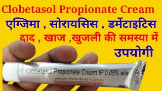 Clobetasol Propionate Cream Uses in Hindi  क्लोबेटासोल प्रोपियोनेट क्रीम के बारे में जानकारी [upl. by Brick]