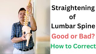 Straightening of Lumbar Spine Loss Of Lumbar Lordosis Spine Straightening Exercises Must Watch [upl. by Helga36]