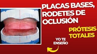 Placas bases rodetes de oclusión y contorno 👅 PASOS Prácticos ProtesisTotales [upl. by Enreval]