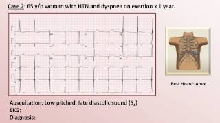 EKG and Heart Murmur Review  Part 1 [upl. by Oneil95]