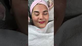 Atendimentos estética estetica beleza youtubeshorts viralvideo [upl. by Nepil]