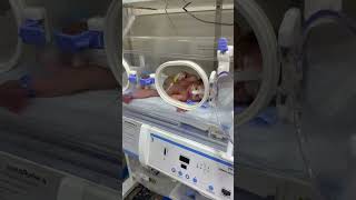 Neonate Baby 👶 babies neonatalicu neonatal infant cute nicu newborn cutebaby baby [upl. by Euqinim]