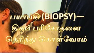 பயாப்சி BIOPSYதிசுப் பரிசோதனை தெரிந்து கொள்வோம்  English Subtitlecancer [upl. by Hadeehsar]