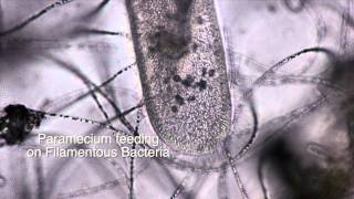 Filamentous Bacteria [upl. by Nnylatsirk]