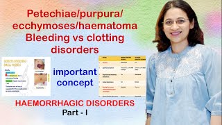 Petechiaepurpuraecchymoseshaematoma Clinical presentation of vesselplateletclotting disorders [upl. by Cohn]