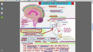 SESSIONS FOR NURSES 23 MENINGITIS [upl. by Eatton39]