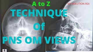 Technique of xray PNS om views Ep26  xray PNS water view Positioning  Bangla tutorial [upl. by Ot]