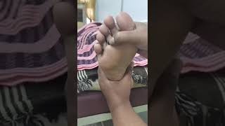 Eye reflex area treatment tutorial tamiltutorial footreflexology chiropractic [upl. by Alicsirp]