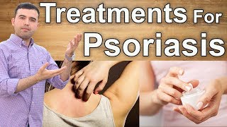 Get Rid of Psoriasis – Natural Cures to Treat Psoriasis Permanently [upl. by Ak184]