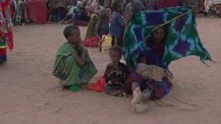 WARNING Distressing Pictures of Famine in Somalia  UNICEF [upl. by Boehike853]