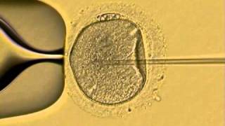 ICSI human sperm injection in vitro Fertility Specialists of Texasavi [upl. by Ahsened]