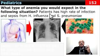 internalmedicine cme usmle محاضراتباطنة ecg كورساتباطنة clinical clinical medicine [upl. by Lenhard119]