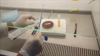 Germ tube test [upl. by Tongue]