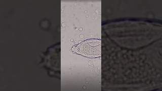 schistosoma haematobium in urine slide test viral shorts [upl. by Gunilla]