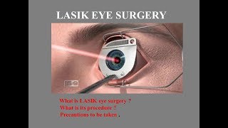 Lasik Eye Surgery  Application of Laser in Medical Science [upl. by Ahsied]