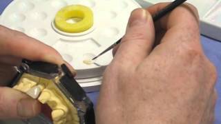 Restoring a tooth Ceramic Glaze and Stain [upl. by Audrye]