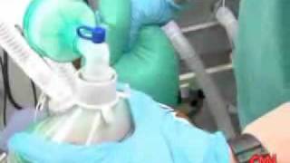 How does a Propofol injection work Dr Sanjay Gupta and Dr Raphael Gershon on CNN [upl. by Dardani]