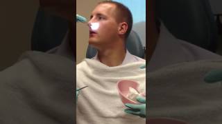 Septoplasty and Turbinate Reduction Splint Removal [upl. by Vories]