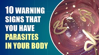 Dont Ignore These Early Symptoms of Parasites In Your Body [upl. by Notsahc778]