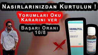 Nasırı Verrutol Yöntemiyle Geçirme 100 Çözüm [upl. by Eiveneg892]