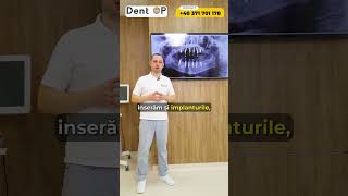 Ce presupune tehnica „Dantură Fixă pe Implanturi Dentare” dentop dentist implantdentar [upl. by Adahs]