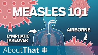 Measles Understanding the most contagious preventable disease  About That [upl. by Ocnarf]