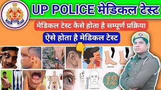 UP POLICE medical video मेडिकल में क्याक्या चेक होता हैUP police medical 2023 [upl. by Ulysses]