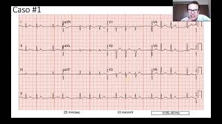 Casos clínicos  Cardiología junio 2022 parte 1 de 3 [upl. by Norry]