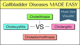 Cholecystitis vs Cholelithiasis vs Cholangitis vs Choledocholithiasis Nursing USMLE [upl. by Brenton50]