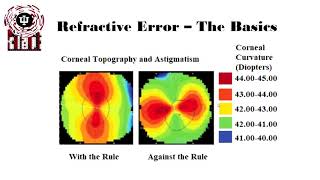 Basics of Astigmatism [upl. by Guerra]