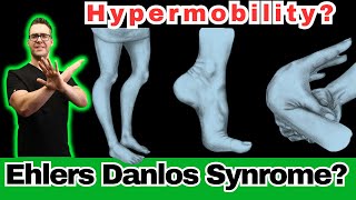 Ehlers Danlos Syndrome Hypermobility Symptoms Diagnosis amp Test [upl. by Ahsinelg]