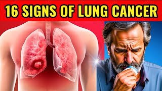 Lung Cancer Signs and Symptoms HealthTrendz3000 [upl. by Eedyak]