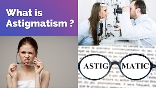 What is Astigmatism  Astigmatism symptoms Astigmatism causes Astigmatism diagnosis and treatment [upl. by Clio]