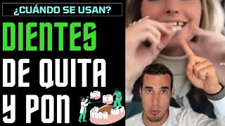 DIENTES DE QUITA Y PON  ¿Cuando se utilizan y cómo funcionan [upl. by Asilef]