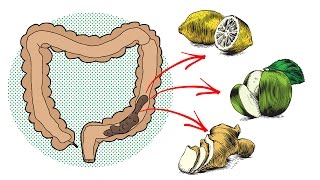 9 Home Remedies for Natural Colon Cleansing [upl. by Vance]