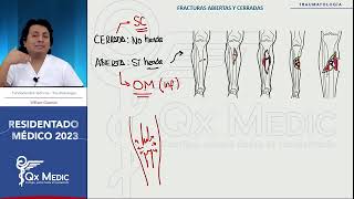 Traumatología  4 Fracturas Generalidades [upl. by Lapo322]