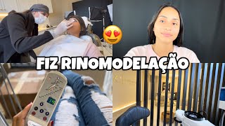 VLOG FIZ RINOMODELAÇÃO NO NARIZ COM ÁCIDO HIALURÔNICO  OLHEM O RESULTADO😍 [upl. by Anaylil]