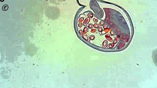 Trichuris trichiura cross section [upl. by Aziza11]