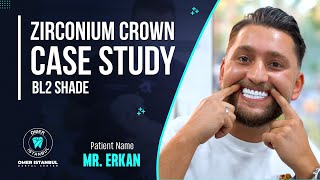 Zirconia Crown Case Study BL2 Shade  Narrated by Dr Omer Karaaslan [upl. by Hako]