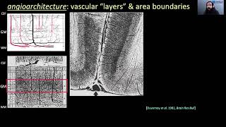 OHBM 2022  Keynote  Jon Polimeni  How far can we go with functional MRI What the blood vessels… [upl. by Allets]