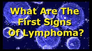 What Are The First Signs Of Lymphoma [upl. by Pius]