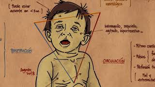 VIDEOCLASE El niño con patología grave [upl. by Fatimah]