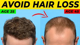 Topical Finasteride For Hair Loss What YOU Need To Know [upl. by Alyaj]