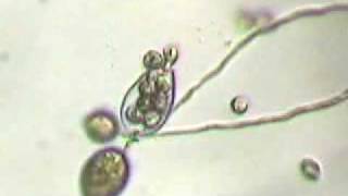 Phytophthora ramorum in action [upl. by Lipkin]