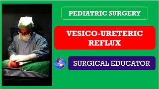 VESICO URETERIC REFLUX How To DIAGNOSE amp TREAT Pediatric Surgery [upl. by Dyraj]