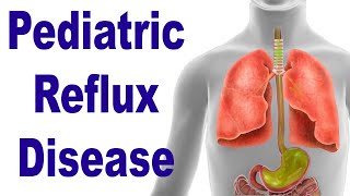 Pediatric Reflux GERD LPR Causes and Symptoms [upl. by Hutner243]